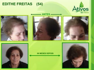 EDITHE FREITAS  (54) 06 MESES DEPOIS ANTES 