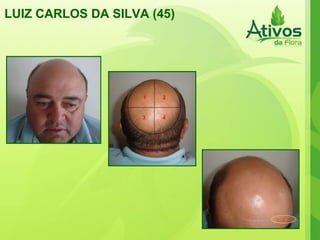 LUIZ CARLOS DA SILVA (45) 1 2 3 4 