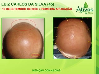 LUIZ CARLOS DA SILVA (45) 10 DE SETEMBRO DE 2008  /  PRIMEIRA APLICAÇÃO MEDIÇÃO COM 42 DIAS 