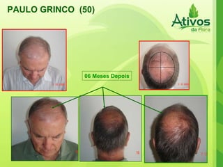 PAULO GRINCO  (50) 06 Meses Depois 