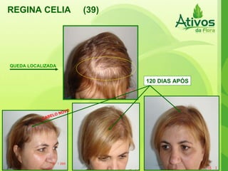 REGINA CELIA  (39) QUEDA LOCALIZADA CABELO NOVO 120 DIAS APÓS 