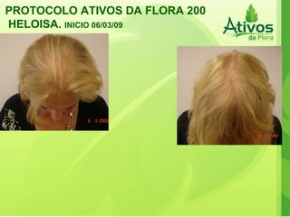 PROTOCOLO ATIVOS DA FLORA 200 HELOISA.  INICIO 06/03/09   