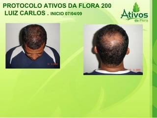 PROTOCOLO ATIVOS DA FLORA 200 LUIZ CARLOS .  INICIO 07/04/09   