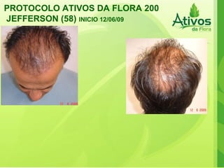 PROTOCOLO ATIVOS DA FLORA 200 JEFFERSON (58)  INICIO 12/06/09   