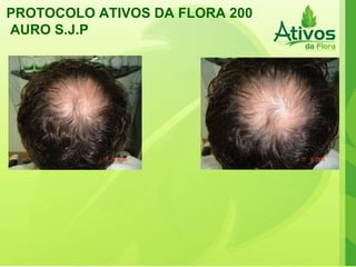 PROTOCOLO ATIVOS DA FLORA 200 AURO S.J.P  