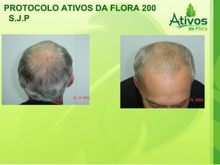 PROTOCOLO ATIVOS DA FLORA 200 S.J.P  