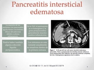 Clasificación de Atlanta 2012 para pancreatitis aguda 