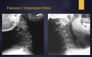 Flexsion / Extension Films
 