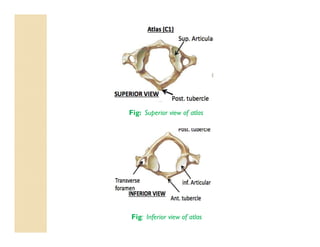 Fig: Superior view of atlas
Fig: Inferior view of atlas
 
