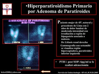 •Hiperparatiroidismo Primario
                        por Adenoma de Paratiroides

                                     Paciente mujer de 45ª, natural y
                                       procedente de Lima con 2
                                       años de dolor lumbar de
                                       moderada intensidad con
                                       irradiación a región de
                                       hipogastrio asociada a
                                       naúseas.
                                       Dx Litiasis renal derecha
                                       Gammagrafía con sestamibi
                                       se visualiza región
                                       hipercaptadora, paratiroides
                                       inferior izquierda


                                    • PTH i post SOP: 6pg/ml se le
                                         realizó adenectomía

helard2000@yahoo.com                 Servicio de Endocrinología –HNAL,H.M.H-2003
                                                                –HNAL,H.M.H-2005
 
