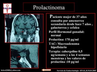 Prolactinoma
                             Paciente mujer de 37 años
                             consulta por amenorrea
                             secundaria desde hace 7 años ,
                             galactorrea y cefalea
                            Perfil Hormonal gonadal:
                             normal
                            Prolactina: 170 pg/ml
                            TAC: Macroadenoma
                             hipofisiario
                            Terapia: cabergoline 0,5
                             ug/semana y a las 4 semanas
                             menstrua y los valores de
                             prolactina :10 pg/ml

helard2000@yahoo.com             Servicio de Endocrinología –HNAL,H.M.H-2003
                                                            –HNAL,H.M.H-2005
 