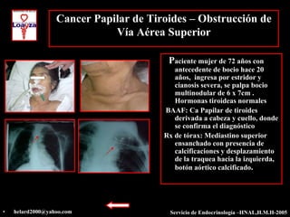 Cancer Papilar de Tiroides – Obstrucción de
                             Vía Aérea Superior

                                        Paciente mujer de 72 años con
                                          antecedente de bocio hace 20
                                          años, ingresa por estridor y
                                          cianosis severa, se palpa bocio
                                          multinodular de 6 x 7cm .
                                          Hormonas tiroideas normales
                                       BAAF: Ca Papilar de tiroides
                                          derivada a cabeza y cuello, donde
                                          se confirma el diagnóstico
                                       Rx de tórax: Mediastino superior
                                          ensanchado con presencia de
                                          calcificaciones y desplazamiento
                                          de la traquea hacia la izquierda,
                                          botón aórtico calcificado.




•   helard2000@yahoo.com                Servicio de Endocrinología –HNAL,H.M.H-2005
 