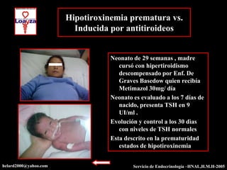 Hipotiroxinemia prematura vs.
                         Inducida por antitiroideos


                                  Neonato de 29 semanas , madre
                                     cursó con hipertiroidismo
                                     descompensado por Enf. De
                                     Graves Basedow quien recibía
                                     Metimazol 30mg/ día
                                  Neonato es evaluado a los 7 días de
                                     nacido, presenta TSH en 9
                                     UI/ml .
                                  Evolución y control a los 30 dìas
                                     con niveles de TSH normales
                                  Esta descrito en la prematuridad
                                     estados de hipotiroxinemia


helard2000@yahoo.com                      Servicio de Endocrinología –HNAL,H.M.H-2005
 