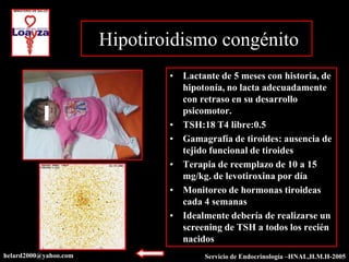 Hipotiroidismo congénito
                               • Lactante de 5 meses con historia, de
                                 hipotonía, no lacta adecuadamente
                                 con retraso en su desarrollo
                                 psicomotor.
                               • TSH:18 T4 libre:0.5
                               • Gamagrafía de tiroides: ausencia de
                                 tejido funcional de tiroides
                               • Terapia de reemplazo de 10 a 15
                                 mg/kg. de levotiroxina por día
                               • Monitoreo de hormonas tiroideas
                                 cada 4 semanas
                               • Idealmente debería de realizarse un
                                 screening de TSH a todos los recién
                                 nacidos
helard2000@yahoo.com                   Servicio de Endocrinología –HNAL,H.M.H-2005
 