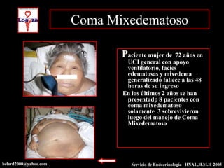 Coma Mixedematoso

                              Paciente mujer de   72 años en
                               UCI general con apoyo
                               ventilatorio, facies
                               edematosas y mixedema
                               generalizado fallece a las 48
                               horas de su ingreso
                              En los últimos 2 años se han
                               presentadp 8 pacientes con
                               coma mixedematoso
                               solamente 3 sobrevivieron
                               luego del manejo de Coma
                               Mixedematoso




helard2000@yahoo.com             Servicio de Endocrinología –HNAL,H.M.H-2005
 