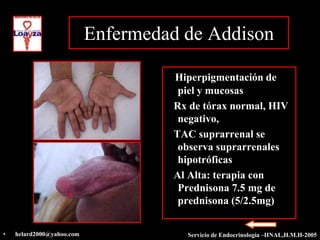 Enfermedad de Addison

                                    Hiperpigmentación de
                                     piel y mucosas
                                    Rx de tórax normal, HIV
                                     negativo,
                                    TAC suprarrenal se
                                     observa suprarrenales
                                     hipotróficas
                                    Al Alta: terapia con
                                     Prednisona 7.5 mg de
                                     prednisona (5/2.5mg)


•   helard2000@yahoo.com              Servicio de Endocrinología –HNAL,H.M.H-2005
 