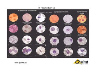 8. Plasmodium sp

www.qualitat.cc

 