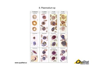 8. Plasmodium sp

www.qualitat.cc

 