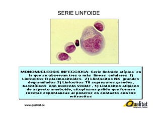 SERIE LINFOIDE

www.qualitat.cc

 