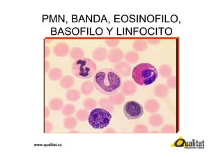 PMN, BANDA, EOSINOFILO,
BASOFILO Y LINFOCITO

www.qualitat.cc

 