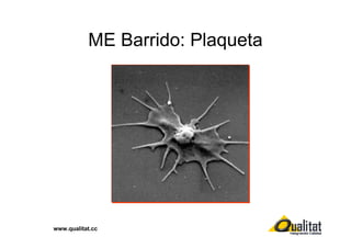 ME Barrido: Plaqueta

www.qualitat.cc

 
