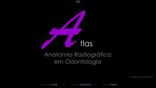 Anatomia Radiográfica
em Odontologia
tlas
Matheus Luciell Alysson Figueredo
& Sérgio Freitas
&
*Imagens – google imagens
 