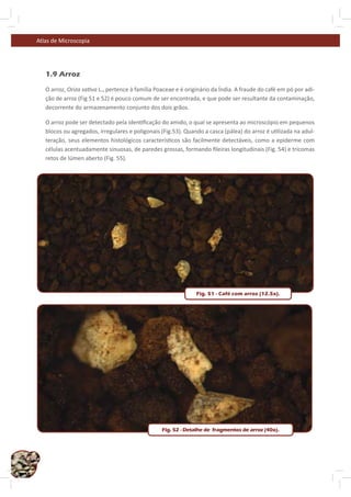Atlas de Microscopia




        1.9 Arroz

        O arroz, Oriza sa va L., pertence à família Poaceae e é originário da Índia. A fraude do café em pó por adi-
        ção de arroz (Fig 51 e 52) é pouco comum de ser encontrada, e que pode ser resultante da contaminação,
        decorrente do armazenamento conjunto dos dois grãos.

        O arroz pode ser detectado pela iden ﬁcação do amido, o qual se apresenta ao microscópio em pequenos
        blocos ou agregados, irregulares e poligonais (Fig.53). Quando a casca (pálea) do arroz é u lizada na adul-
        teração, seus elementos histológicos caracterís cos são facilmente detectáveis, como a epiderme com
        células acentuadamente sinuosas, de paredes grossas, formando ﬁleiras longitudinais (Fig. 54) e tricomas
        retos de lúmen aberto (Fig. 55).




                                                                    Fig. 51 - Café com arroz (12.5x).




                                                      Fig. 52 - Detalhe de fragmentos de arroz (40x).




34
 