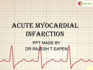 Acute MyocArdiAl
infArction
PPT MADE BY
DR RAJESH T EAPEN
 