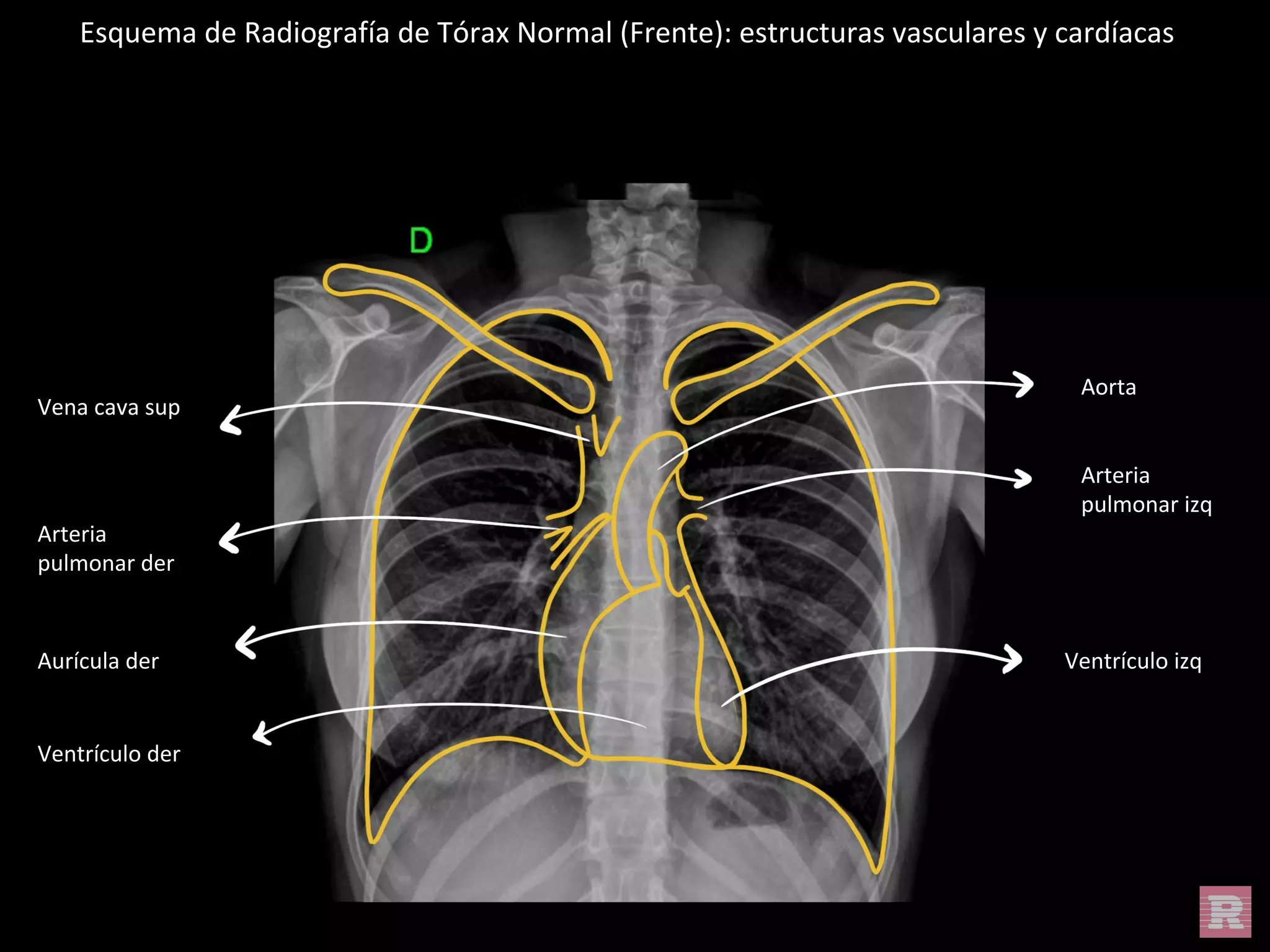 Torax Simple ATLAS ANATOMIA NORMAL TORAX .pptx (1).pdf