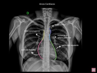 Arcos Cardíacos
 
