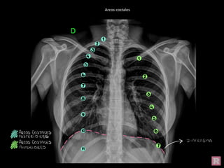 Arcos costales
 