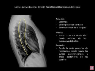 Límites del Mediastino: División Radiológica (Clasificación de Felson)
Anterior:
- Esternón
- Borde posterior cardíaco
- Borde anterior de la tráquea
Medio:
- Hasta 1 cm por detrás del
borde anterior de los
cuerpos vertebrales.
Posterior:
- Desde la parte posterior de
mediastino medio hasta los
surcos paravertebrales y
áreas posteriores de las
costillas.
P M A
 