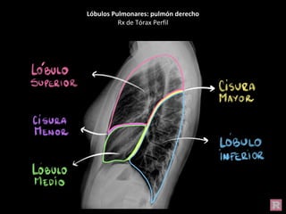 Lóbulos Pulmonares: pulmón derecho
Rx de Tórax Perfil
 