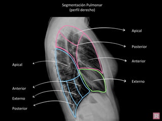 Segmentación Pulmonar
(perfil derecho)
Apical
Posterior
Anterior
Externo
Apical
Anterior
Externo
Posterior
 