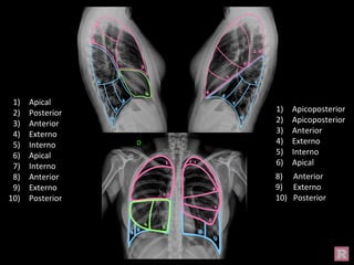 1) Apical
2) Posterior
3) Anterior
4) Externo
5) Interno
6) Apical
7) Interno
8) Anterior
9) Externo
10) Posterior
1) Apicoposterior
2) Apicoposterior
3) Anterior
4) Externo
5) Interno
6) Apical
8) Anterior
9) Externo
10) Posterior
 