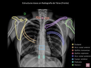 Estructuras óseas en Radiografía de Tórax (Frente)
 