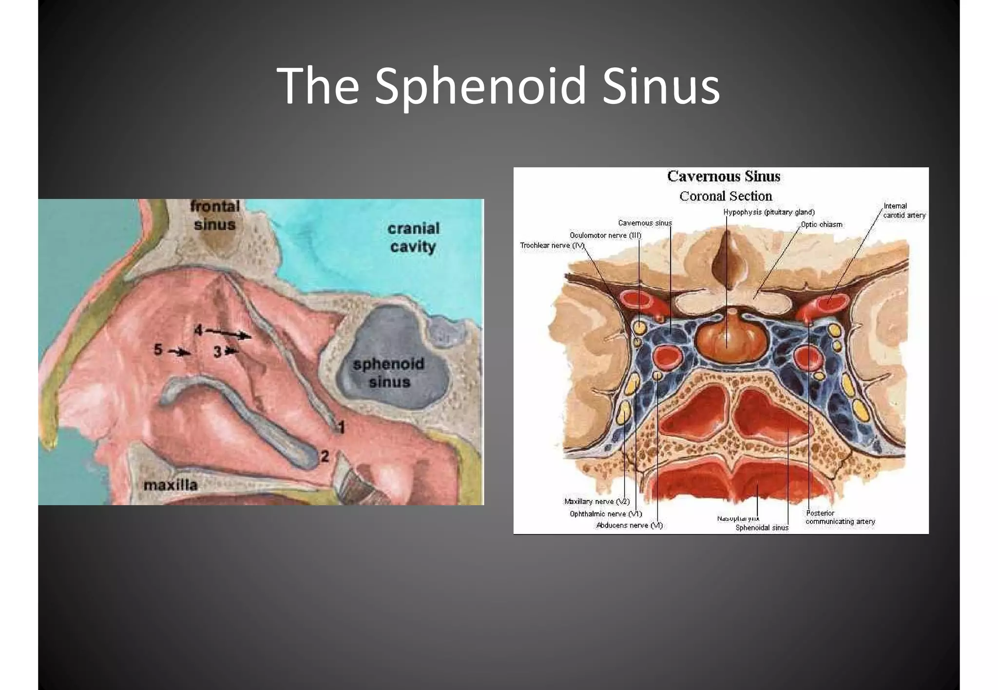 Atlas anatomy of the nose and paranasal sinuses | PDF