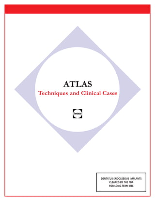 ATLAS 
Techniques and Clinical Cases 
DENTATUS ENDOSSEOUS IMPLANTS 
CLEARED BY THE FDA 
FOR LONG-TERM USE 
 