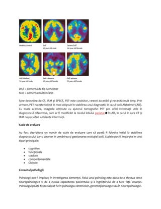 DAT = demenţă de tip Alzheimer 
MID = demenţă multi-infarct 
Spre deosebire de CT, IRM şi SPECT, PET este costisitor, rareori accesibil şi necesită mult timp. Prin 
urmare, PET nu este folosit în mod obişnuit în stabilirea unui diagnostic în cazul bolii Alzheimer (AD). 
Cu toate acestea, imaginile obţinute cu ajutorul tomografiei PET pot oferi informaţii utile în 
diagnosticul diferenţial, cum ar fi modificări la nivelul lobului parieta l în AD, în cazul în care CT şi 
IRM nu pot oferi suficiente informaţii. 
Scale de evaluare 
Au fost dezvoltate un număr de scale de evaluare care să poată fi folosite iniţial la stabilirea 
diagnosticului dar şi ulterior în urmărirea şi gestionarea evoluţiei bolii. Scalele pot fi împărţite în cinci 
tipuri principale: 
· cognitive 
· funcţionale 
· stadiale 
· comportamentale 
· Globale 
Consultul psihologic 
Psihologii pot fi implicaţi în investigarea demenţei. Rolul unui psiholog este acela de a efectua teste 
neuropsihologice şi de a evalua capacitatea pacientului şi a îngrijitorului de a face faţă situaţiei. 
Psihologul poate fi specializat fie în psihologia vârstnicilor, gerontopsihologie sau în neuropsihologie. 
 