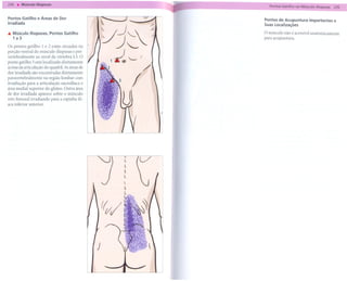 [ .234'-M(;scJlolliopsoas-
                        -
                                           ----                                                     --
                                                                       ~=-   --    ------- no Músculo lIIopsoas
                                                                                    Pontos Gatilho                    235   1

  Pontos Gatilho e Áreas de Dor
  Irradiada                                                                       Pontos de Acupuntura Importantes e
                                                                  /              Suas Localizações
  ... Músculo lIiopsoas. Pontos Gatilho                                           O músculo não é acessívelanatomicamente
      1a 3

  Os pontos gatilho 1 e 2 estão situados na           ~j~~.
                                                        J
                                                                                  para acupuntura.


  porção ventral do músculo iliopsoas e pré-
  vertebralmente ao nível da vértebra L3. O
  ponto gatilho 3 está localizado diretamente
                                                           ~,--J
                                                          1&~
  acima da articulação do quadril. As áreas de
  dor irradiada são encontradas diretamente
  paravertebralmente     na região lombar com
  irradiação para a articulação sacroilíaca e
  área medial superior do glúteo. Outra área
  de dor irradiada aparece sobre o músculo
  reto femoral irradiando para a espinha ilí-
  aca inferior anterior.




                                                  )
 