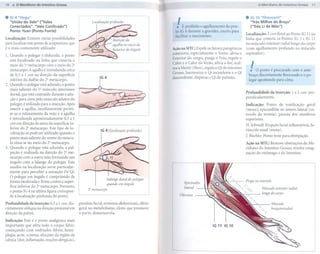 li O Meridiano do Intestino Grosso                                                                                                                                                          11


.   IG 4 "Hegu"                                                                                                                                   . IG10"Shousanli"
    "União do Vale" ("Vales
    Conectados", "Vale Confinado")
    Ponto Yuan (Ponto Fonte)
                                                          Localização profunda
                                                                                                    !   É proibido o agulhamento do pon.
                                                                                                    to IG 4 durante a gravidez, exceto para
                                                                                                                                                     "Três Milhas do Braço"
                                                                                                                                                     ("Três Li da Mão")

                                                                                                                                                  Localização: 2 cun distal ao Ponto IG 11 na
                                                                                                    facilitar o nascimento.
Localização: Existem várias possibilidades                                                                                                        linha que conecta os Pontos IG 5 e IG 11
para localizareste ponto de acupuntura, que                                                                                                       no músculo extensor radial longo do carpo
é o mais comumente utilizado:                                                                     Ação na MTC: Expele os fatores patogênicos      (com agulhamento profundo no músculo
                                                                                                  exteriores, especialmente o Vento; alivia o     supinador).
1. Quando o polegar é abduzido, o ponto
                                                                                                  Exterior do corpo, purga o Frio, expele o
   está localizado na linha que conecta o

                                                                                                                                                     !
                                                                                                  Calor e o Calor do Verão, alivia a dor, acal-
   meio do 1" metacarpo com o meio do 2"
                                                                                                  ma a Mente (Shen), regula o Qi do intestino
   metacarpo. A agulha é introduzida cerca
                                                                                                  Grosso, harmoniza o Qi ascendente e o Qi
                                                                                                                                                         O ponto é procurado com o arlte-
   de 0,5 a 1 cun na direção da superfície                                                                                                          braço discretamente flexionado e o po.
                                                               IG4                                descendente,   dispersa o Qi do pulmão.
   inferior da diáfise do 2" metacarpo.                                                                                                             legar apoptando para cima.
2. Quando o polegar está aduzido, o ponto
   mais saliente do 10 músculo interósseo
                                                                                                                                                  Profundidade     da inserção:     1 a 2 cun, per-
   dorsal, que está contraído durante a adu-
                                                                                                                                                  pendicularmente.
   ção e para cima pelo músculo adutor do
   polegar, é utilizado para a inserção. Após                                                                                                     Indicação:  Ponto de tonificação     geral
   inserir a agulha, imediatamente permi-                                                                                                         (moxa); epicondilite no úmero lateral (co-
   te-se o relaxamento da mão e a agulha                                                                                                          tovelo do tenista), pares ia dos membros
   é introduzida aproximadamente        0,5 a 1                                                                                                   supenores.
   cun em direção do meio da superfície in-                                                                                                       H. Schmidt: Erupção facial inflamatória,      fu-
   ferior do 2" metacarpo. Este tipo de lo-                                                                                                       rúnculo nasal (moxa).
                                                                IG 4 (localização profunda)
   calização só pode ser utilizado quando o
   ponto mais saliente do ventre do múscu-
                                                                                                                                                  J.Bischko:   Ponto teste para obstipação.
   lo situa-se no meio do 20 metacarpo.                                                                                                           Ação na MTC: Remove obstruções do Me-
3. Quando o polegar está aduzido, a pal-                                                                                                          ridiano do Intestino Grosso, resolve estag-
   pação é realizada na direção do 2Qme-                                                                                                          nação do estômago e do Intestino.
   tacarpo com a outra mão formando um
   ângulo com a falange do polegar. Este
   auxílio na localização serve particular-
   mente para perceber a sensação De Qi.
                                                     -I
   O polegar em ângulo é comprimido de
                                                                      Falange distal do polegar
   forma moderada e firme contra a super-                                                                Epicôndilo
                                                                      quando em ângulo
   fície inferior do 2" metacarpo. Portanto,                                                             lateral                                               Músculoextensor    radial
                                                       2" metacarpo
   o ponto IG 4 na última figura correspon-
                                                                                                      Olécrano                                                 longodo carpa
   de à localização profunda do ponto.

Profundidade   da inserção: 0,5 a 1 cun, dis-     paralisia facial, sintomas abdominais, efeito
cretamente oblíqua na direção proximal em         geral no metabolismo, efeito que promove
direção da palma.                                 o parto, dismenorréia.

Indicação: Este é o ponto analgésico mais
importante que afeta todo o corpo; febre,
começando com resfriados febris, hemi-                                                                                                                            ~
plegia, acne, eczema, afecções da região da
cabeça (dor, inflamação, reações alérgicas),
                                                                                                                                                                  ~
 