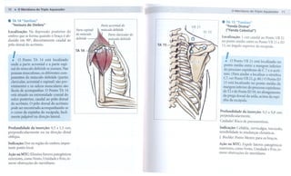 70.      O lIIIeridlano do Triplo Aquecedor
                                                                                                    o Meridiano do Triplo Aquecedor       71

.     TA 14 uJianliao"
      "Incisura do Ombro"                              Parte acromial    do
                                                                                            .   TA 15 "Tianliao"
                                                                                                "Fenda    Divina"
                                                       músculo   deltóide
Localização: Na depressão posterior do                                                          ("Fenda   Celestia''')
                                                            Parte c/avicular do
ombro que se forma quando o braço é ab-                                                     Localização: 1 cun caudal ao Ponto VB 21
                                                            músculo     deltóide
duzido em 90°, discretamente caudal ao
                                                                                            no ponto médio entre os Ponto VB 21 e ID
pólo dorsal do acrômio.                                                            TA 15
                                                                                            13, no ângulo superior da escápula.
                                               TA 14

    .
    I    O Ponto    TA 14 está localizado
    onde a parte acromial e a parte espi-
                                                                                                I
                                                                                                .   O Ponto VB 21 está localizado no
                                                                                              ponto médio entre a margem inferior
    nal do músculo deltóide se juntam. Nas                                                    do processo espinhoso de C 7 e o acrô-
    pessoas musculosas, os diferentes com-                                                   mio. (Para ajudar a localizar a vértebra
    ponentes do músculo deltóide (partes                                                     C7, ver Ponto VB 21, p. 80.) O Ponto ID
    clavicular, acromial e espinal) são pro-                                                  13 está localizado no ponto médio da
    eminentes e os sulcos musculares são
                                                                                             margem inferior do processo espinhoso
    fáceis de acompanhar. O Ponto TA 14
                                                                                             de T2 e do Ponto ID 10, no alongamento
    está situado na extremidade cranial do
                                                                                             da prega dorsal da axila, acima da espi-
    sulco posterior, caudal ao pólo dorsal                                                   nha da escápula.
    do acrômio. O pólo dorsal do acrômio
    pode ser encontrado acompanhando-se
    o curso da espinha da escápula, facil-                                                 Profundidade    da inserção:   0,5 a 0,8 cun,
    mente palpável na direção lateral.                                                     perpendicularmente.
                                                                                           Cuidado! Risco de pneumotórax.
Profundidade    da inserção: 0,5 a 1,5 cun,                                                Indicação: Cefaléia, cervicalgia, torcicolo,
perpendicularmente     ou na direção distal                                                sensibilidade às mudanças climáticas.
oblíqua.                                                                                   J. Bischko: Ponto Mestre para os braços.
Indicação: Dor na região do ombro; impor-                                                  Ação na MTC: Expele fatores patogênicos
tante ponto local.                                                                         exteriores, como Vento, Umidade e Frio, re-
Ação na MTC: Elimina fatores patogênicos                                                   move obstruções do meridiano.
exteriores, como Vento, Umidade e Frio, re-
move obstruções      do meridiano.
 