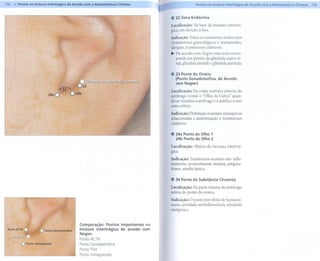 132.111<
       Pontos na Incisura Intertrágica de Acordo com a Nomenclatura Chinesa                           Pontos na Indsuralntertrágica    de Acordo com a Nomenclatura Chinesa   133


                                                                                  1   .   22 Zona Endócrina
                                                                                      Localização:   Na base da incisura intertrá-
                                                                                      gica, em direção à face.
                                                                                      Indicação: Todos os transtornos endócrinos
                                                                                      (transtornos ginecológicos e reumatóides,
                                                                                      alergias, transtornos cutâneos).
                                                                                      ~ De acordo com Nogier, esta zona corres-
                                                                                        ponde aos pontos da glândula supra-re-
                                                                                        nal, glândula tireóide e glândula parótida.

                                                                                      . 23 Ponto do Ovário
                                                                                        (Ponto Gonadotrofina, de Acordo
                                                ~~                                      com Nogier)
                                              ~3
                                                                                      Localização: Na crista ventral e externa do
                                                                                      antitrago (como o "Olho da Cobra" quan-
                                                                                      do se visualiza o antitrago e a antélice como
                                                                                      uma cobra).

                                                                                      Indicação: Disfunção ovariana, enxaquecas
                                                                                      relacionadas a menstruação e transtornos
                                                                                      cutâneos.

                                                                                      " 24a Ponto do Olho 1
                                                                                        24b Ponto do Olho 2
                                                                                      Localização:   Abaixo da incisura    intertrá-
                                                                                      glCa.

                                                                                      Indicação: Transtornos oculares não-infla-
                                                                                      matórios, possivelmente miopia, astigma-
                                                                                      tismo, atrofia óptica.

                                                                                      " 34 Ponto da Substância Cinzenta
                                                                                      Localização: Na parte interna do antitrago
                                                                                      acima do ponto do ovário.

                                                                                      Indicação: O ponto tem efeito de harmoni-
                                                                                      zação, atividade antiinflamatória, atividade
                                                                                      analgésica.



                                            Comparação: Pontos importantes na
                                            incisura intertrágica de acordo com
                                            Nogier.
                                            Ponto ACTH
         o   Ponto Antíagressão              Ponto Gonadotrofina
                                             PontoTSH
                                             Ponto Antiagressão
 