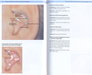 P                 ----
146 111 ontos dos Plexos na Concha de Acordo com Nogier                                         PontQs dosPlexos na Concha de ACQrdocQrnNogier   147


                                                           .   Ponto do Plexo Cardíaco
                                                           Localização: Ventral ao Ponto do Gânglio
                                                           Cervical Médio, no nível do C2/3.

                                                           Indicação: Hipertensão, patologias car-
                                                           díacas funcionais.

                       C   Ponto do Plexo'
                           Hipogástrico                    . Ponto do Plexo Broncopulmonar
                           (Ponto Ômega 1)
                                                           Localização: Na concha inferior, ventral ao
                                                           Ponto Final da Zona do Plexo Solar (Ponto




                           ~
                                                           da Opressão).
               """'z..rn. .
              PontodoPlexo
              Broncopulmonar
                              O":', doP>,rn'
                               <   ,
                                                  <
                                                           Indicação: O ponto tem atividade bron-
                                                           quiolítica.

                                       Ponto da Opressão   . Zona do Plexo Solar

                                                           Localização: A zona incluindo o Ponto Zero
                                                           (Ponto 82) e o Ponto da Opressão (Pon-
                                                           to 83).
                                                           Indicação:   Queixas gastrintestinais.


                                                           .   Ponto do Plexo Hipogástrico          (Ponto
                                                               do Plexo Urogenital)

                                                           Localização: Na margem superior do ramo
                                                           da hélice, em direção da concha superior,
Comparação: Zonas de projeção dos ór-                      aproximadamente       na porção média entre
gãos internos de acordo com Nogier.                        o Ponto Zero e a interseção do ramo ascen-
                                                           dente da hélice e o ramo inferior da antélice.
                                                           Idêntico ao Ponto Ômega 1.

                                                           Indicação: Queixas gastrintestinal       e uroge-
                                                           nital, cólica renal.
 