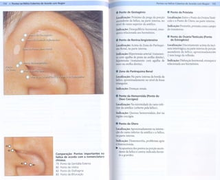 154 li! Pontos na Hélice Cobertos de Acordo com Nogier                                                                          Pontos na Hélice Cobertos de Acordo com Nogier       155


                                                                                    .   Ponto de Gestagênio                              . Ponto da Próstata
                                                                                    Localização: Próximo da prega da porção               Localização: Entre o Ponto do Ovário/Testí-
                                                                                    ascendente da hélice, na parte interna, no            culo e o Ponto do Útero, na parte interna.
                                                                                    nível do ramo superior da antélice.
                                                                                                                                          Indicação: Prostatite, próstata como campo
 ;;                                                                                 Indicação:    Desequilíbrio   hormonal,      enxa-    do transtorno.

                 o                                                                  queca relacionada     aos hormônios.
                                                                                                                                         .   Ponto do OváriolTestículo      (Ponto
                                                                                    . Pontode Renina/Angiotensina                            do Estrogênio)


         r~                                                                         Localização: Acima da Zona do Parênqui-                Localização: Discretamente acima da inci-


        ~                                                                           ma Renal, na parte interna.
                                                                                    Indicação: Hipertensão arterial (tratamen-
                                                                                    to com agulha de prata na orelha direita),
                                                                                                                                           sura intertrágica, na parte interna da porção
                                                                                                                                         . ascendente da hélice, aproximadamente
                                                                                                                                           2 mm longe da reflexão.

                                                                                    hipotensão   (tratamento  com agulha de               Indicação: Disfunção hormonal, enxaqueca
                                                                                    ouro na orelha direita).                              relacionada aos hormônios.


                                                                                    . Zona do Parênquima Renal
                                                                                    Localização: Na parte interna da borda da
                                                                                    hélice, aproximadamente no nível da fossa
                                                                                    triangular.
                                                                                    Indicação:    Doenças renais.

                                                                                    . Pontoda HemorróidaPontodo
                                                                                                       (
                                                                                        0550 Coccígeo)

                                                                                    Localização: Na extremidade do ramo infe-
                                                                                    rior da antélice (coberto pela hélice).

                                                                                    Indicação: Queixas hemorroidais,            dor na
                                                                                    região coccígea.

                                                                                    . Ponto do Útero
                                                                                    Localização: Aproximadamente na interse-
                                                                                    ção do ramo inferior da antélice e a hélice,
                                                                                    na parte interna.

                                                                                    Indicação: Dismenorréia,        problemas     após
                                                                                    a histerectomia.
                                                                                    ~ Acupuntura dos pontos na porção ascen-
                                                                                      dente da hélice é contra-indicada duran-
                                              Comparação: Pontos importantes na         te a gravidez.
                                              hélice de acordo com a nomenclatura
                                              chinesa.
                                              79 Pontoda GenitáliaExterna
                                              80 Pontoda Uretra
                                              82 Pontodo Diafragma
                                              83 Pontoda Bifurcação
 