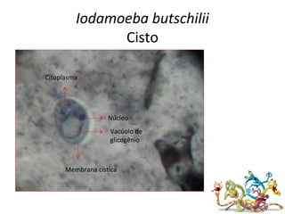 Iodamoeba butschilii
Cisto
Núcleo
Vacúolo de
glicogênio
Citoplasma
Membrana cística
 