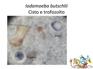 Iodamoeba butschlii
Cisto e trofozoíto
Cisto
Trofozoíto
 