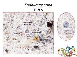 Endolimax nana
Cisto
Núcleos
Membrana
cística
Corpo
cromatóide
 