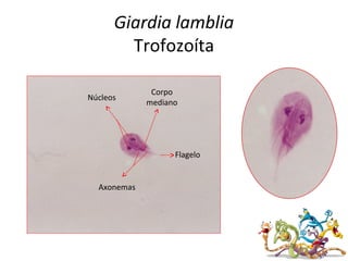 Giardia lamblia
Trofozoíta
Núcleos
Corpo
mediano
Flagelo
Axonemas
 