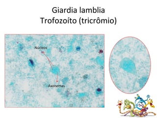 Giardia lamblia
Trofozoíto (tricrômio)
Núcleos
Axonemas
 